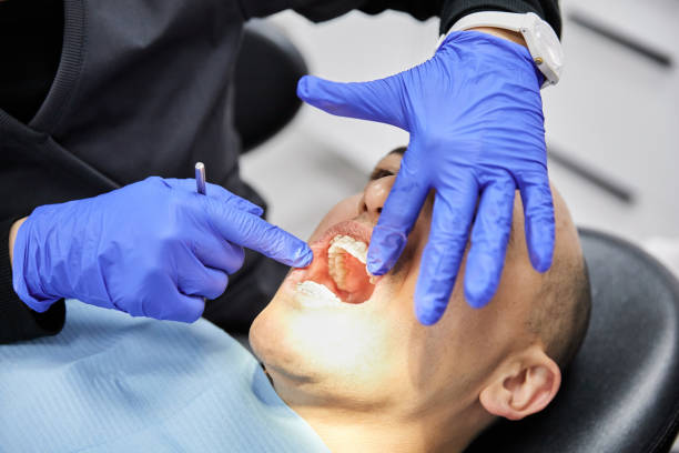 Best Emergency Root Canal Therapy in Frederickson, WA