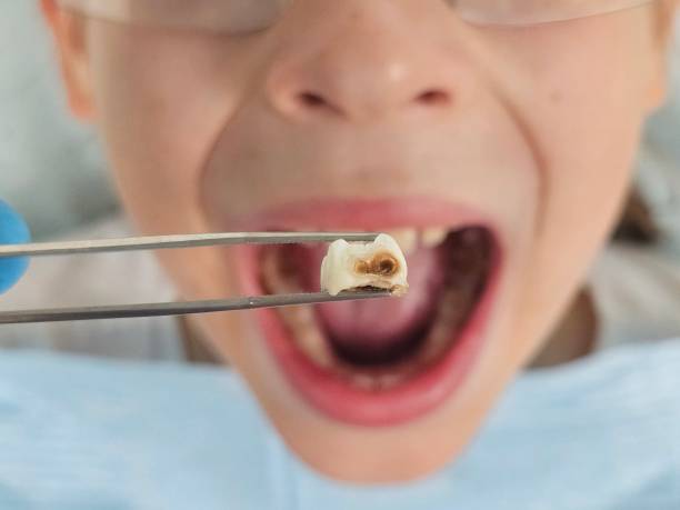 Best Emergency Treatment for Jaw Pain or Injury in Frederickson, WA